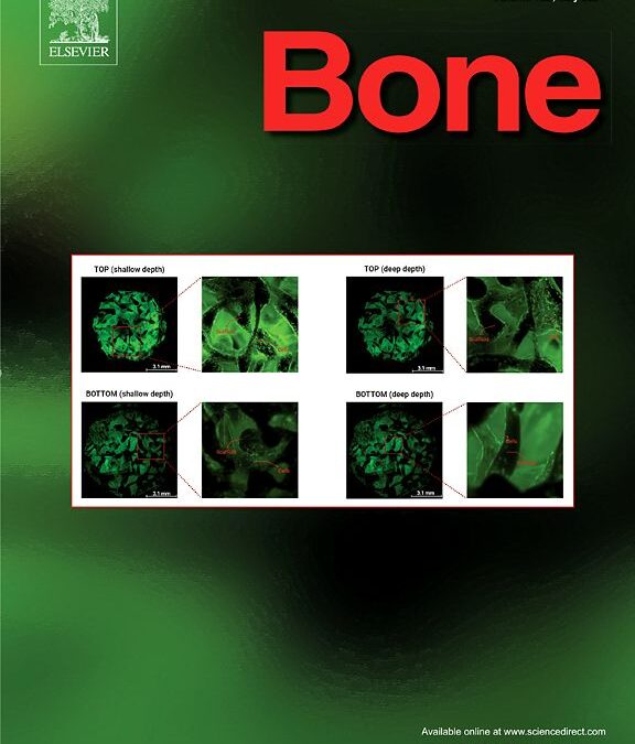 “Bone” features our research
